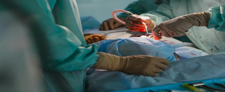 breast cancer surgery