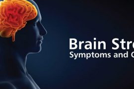 10 Brain Stroke Symptoms that Serve as Indicative Warnings