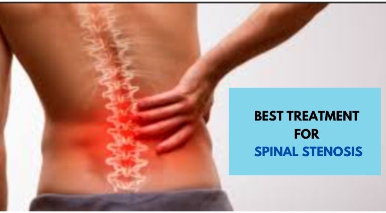 Best Treatment for Spinal Stenosis