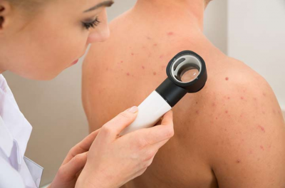 Can Skin Conditions help You Detect an Illness