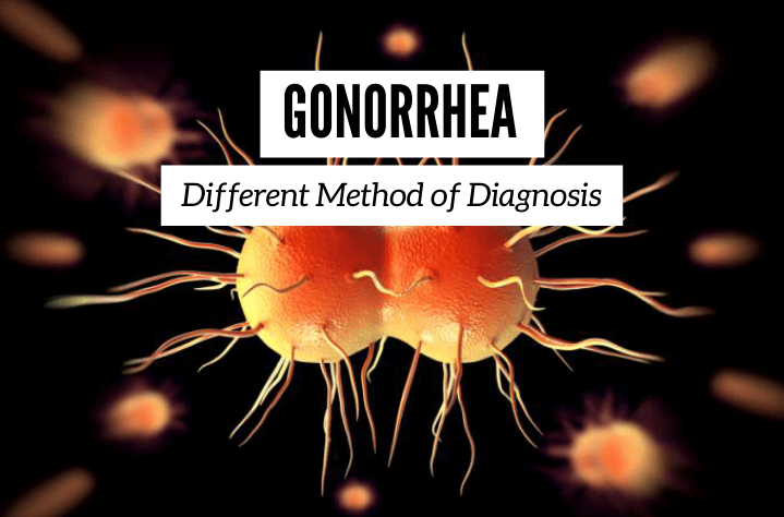 Gonorrhea - Different Method of Diagnosis