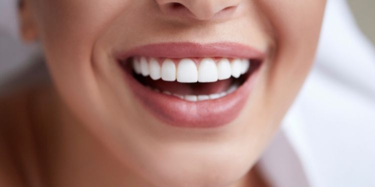 Cosmetic Teeth Whitening Treatment in Lahore of COVID-19