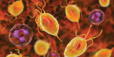 Trichomoniasis