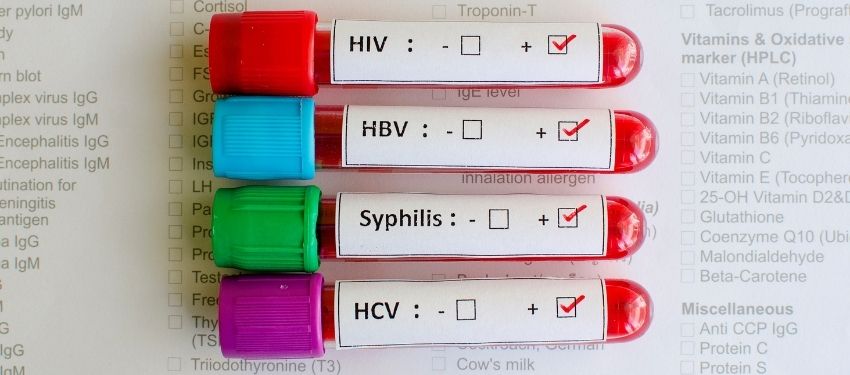 Sexually-Transmitted-Infections