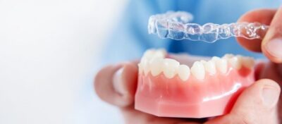 invisalign Braces