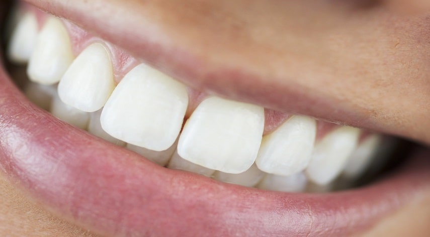 underbite vs overbite