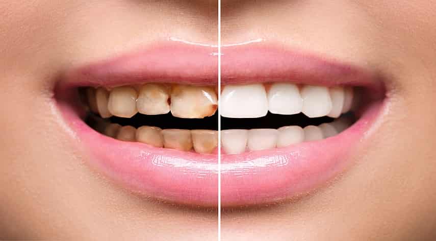 cosmetic dentistry