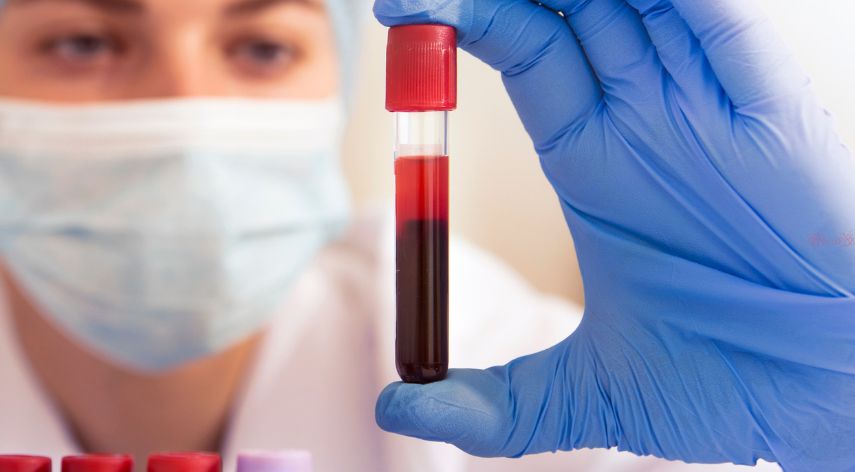 Private Blood Test