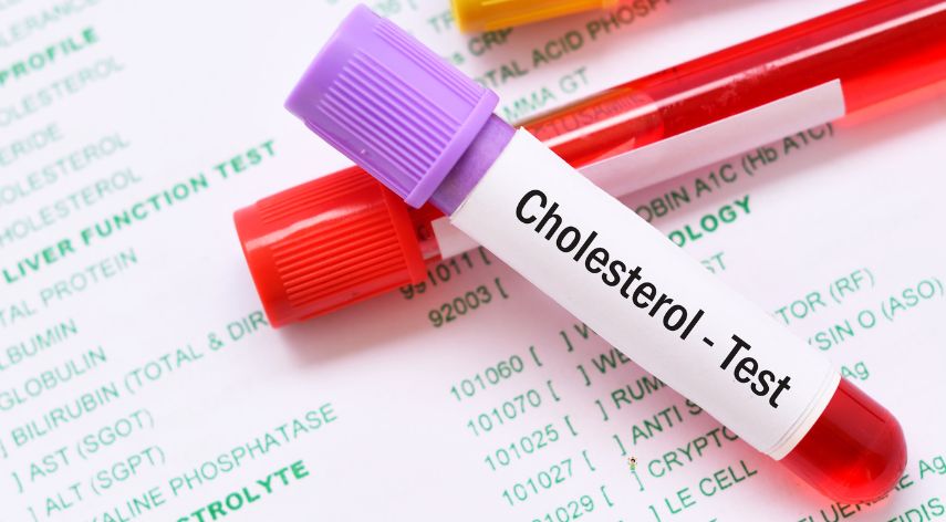 Complete Lipid Profile: HDL, LDL, Triglycerides Explained
